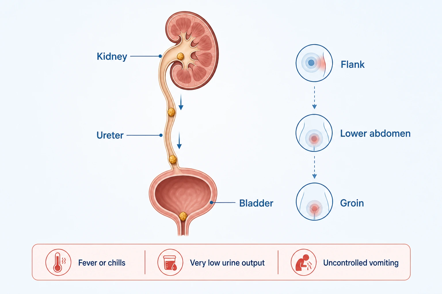 Kidney stones pain symptoms diagram